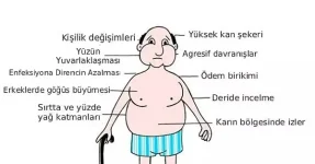 cushing-sendromu.webp cushing-sendromu.webp