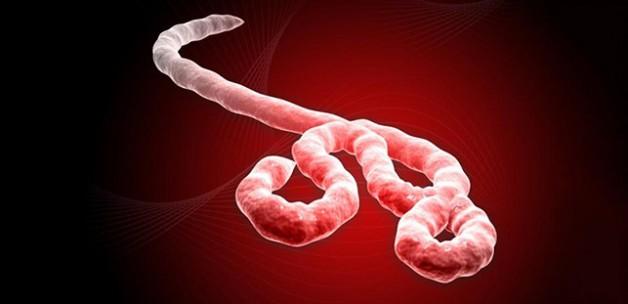 Ebola virüsünün tedavisi bulundu